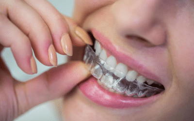 The Benefits of Invisalign for Adults and Teens
